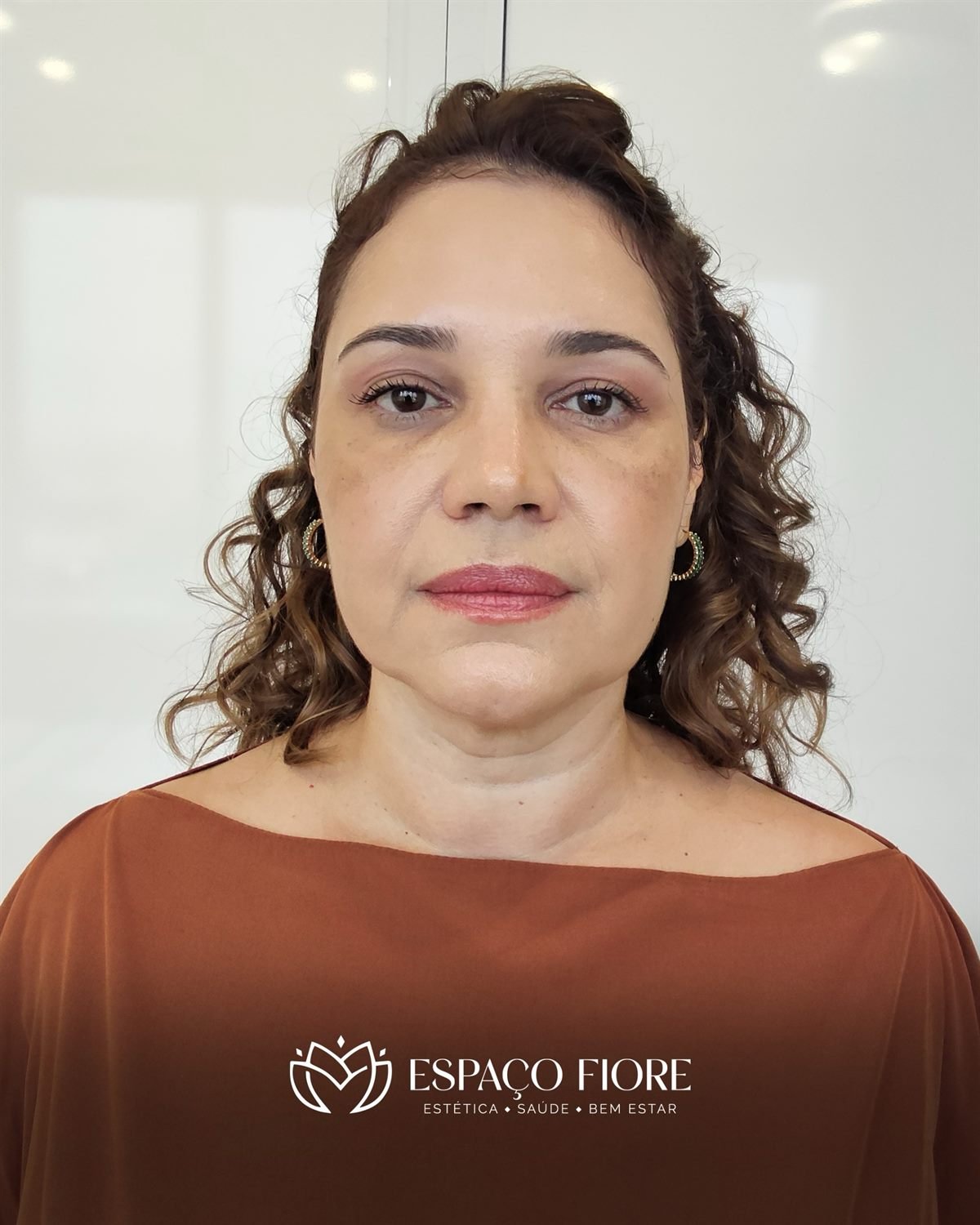 Paciente de frente, depois do tratamento